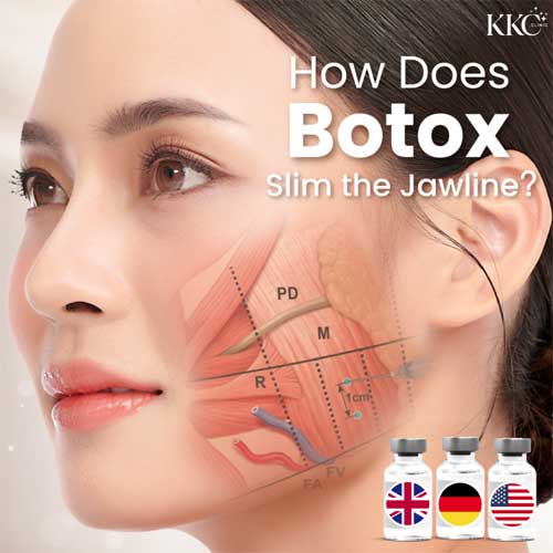 Botox μασητήρα