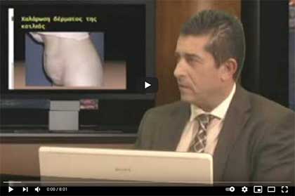 κοιλιοπλαστική